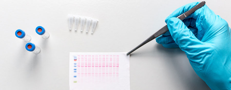 Western Blot